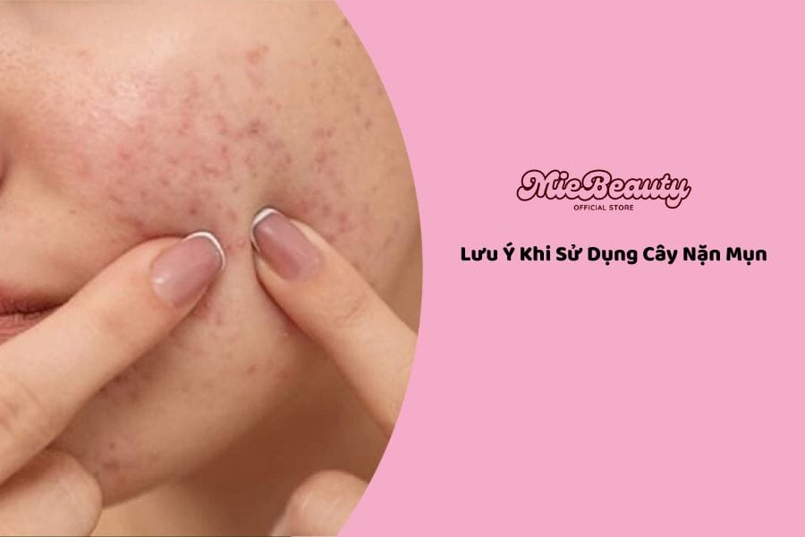 Lưu Ý Khi Sử Dụng Cây Nặn Mụn