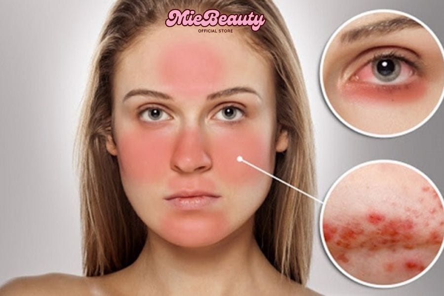Sản phẩm đi kèm không phù hợp